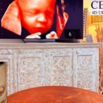 4D Baby Scan Perth – Capture Your Baby’s HD Moments in West Perth