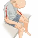 Effective physical therapy treatment for back pain: expert tips