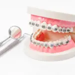 Invisalign Price: Clear, Honest Guidance for Your Smile