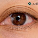 Eye Surgery: Pterygium Removal — Safe, Clear Vision