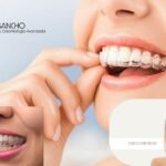 Ortodoncia precio Pozuelo: sonrisas asequibles en Clínica Vilar Sancho