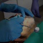 Airway Dentistry Newmarket – Professional, Family‑Focused Care