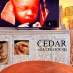 Pregnancy Ultrasound Perth – Gentle 2D, 3D & 4D Scans