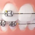 Cosmetic Dentist Conroe | Transform Your Smile with Care