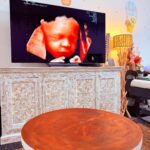 Gender Reveal Ultrasound in Perth | Cedar4D Ultrasound
