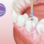 Clínica Dental Gines: Somriures saludables amb atenció personalitzada