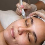 Vitamin C Facial Brampton: Brighten and Rejuvenate Your Skin