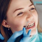 Dental Bonding in Charlotte | Restore Your Smile with Care